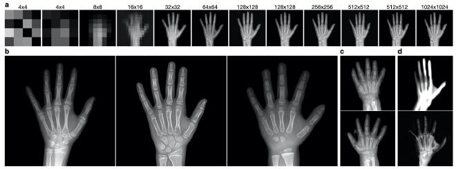 Figure 1. Examples from the PGGAN trained on hand radiographs.